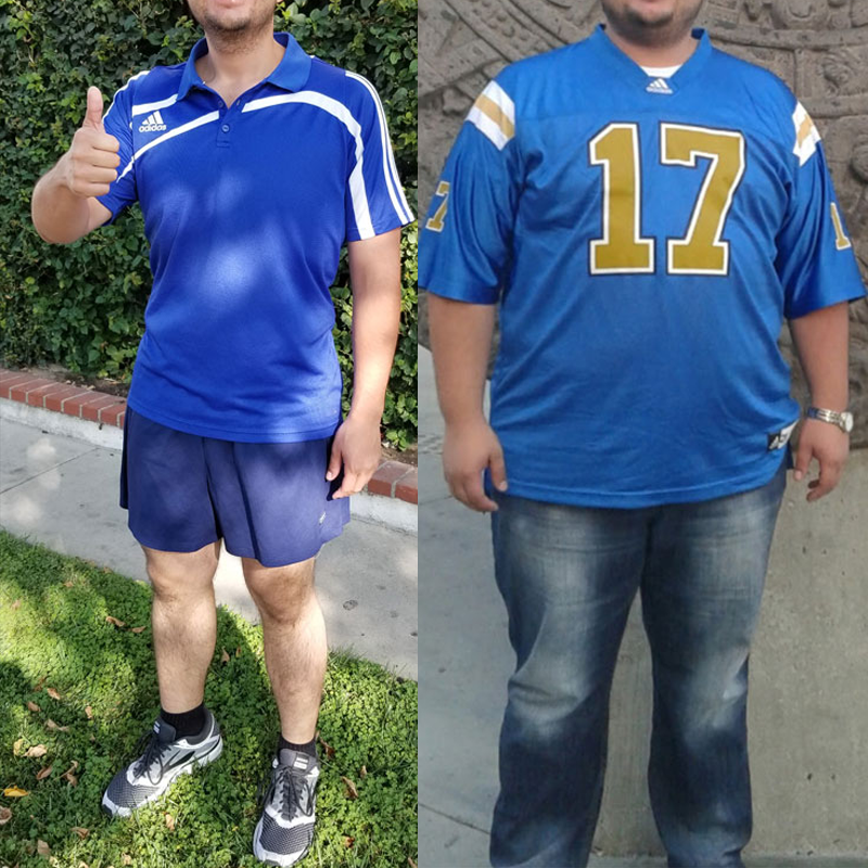 Before After 3